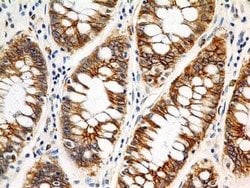 FSHR Antibody (6E8.2F5) - Azide and BSA Free, Novus Biologicals 0.1 mg;